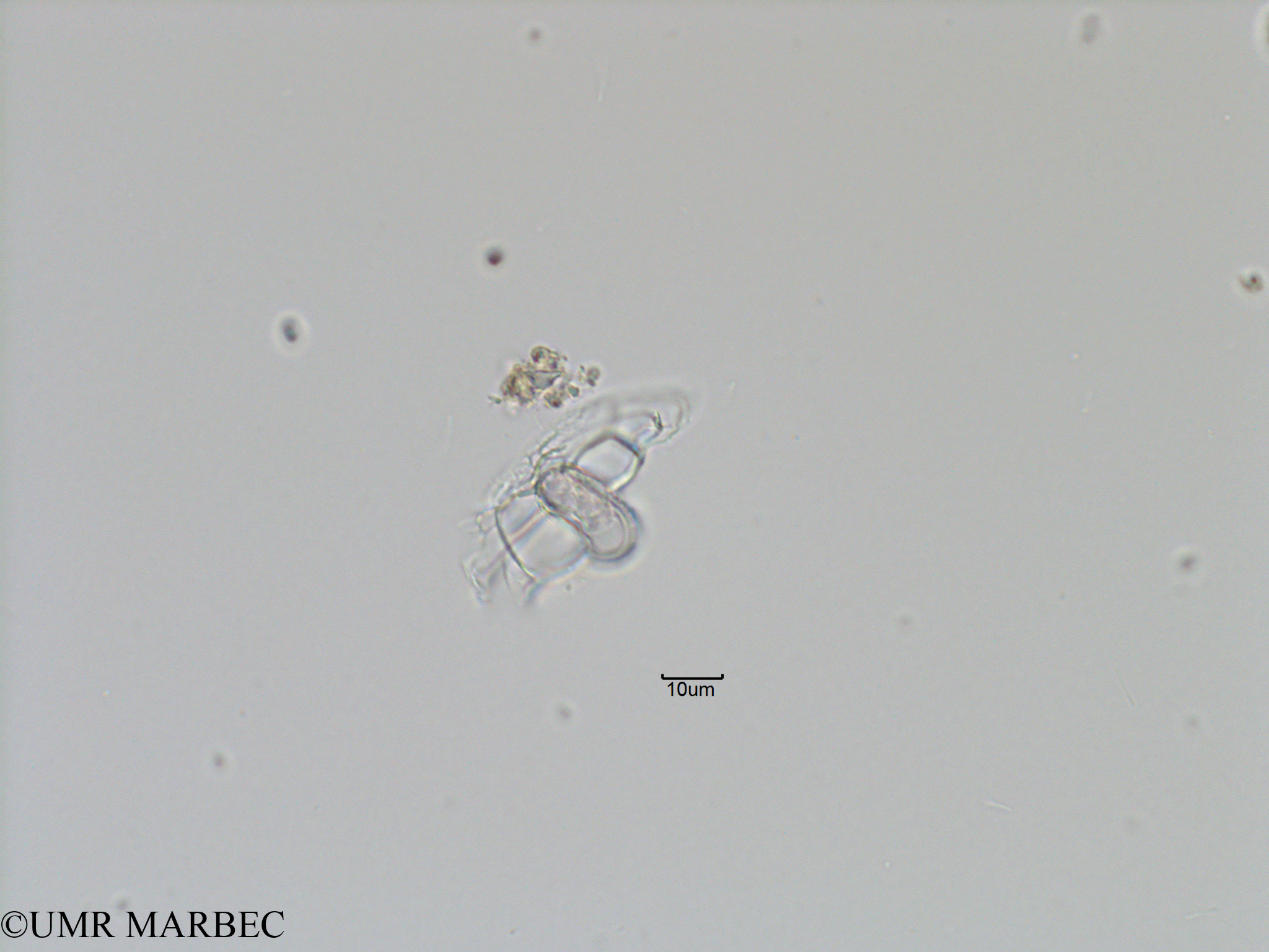 phyto/Bizerte/bizerte_bay/RISCO November 2015/Histioneis sp1 (Baie_T5-C2-Histioneis-0).tif(copy).jpg